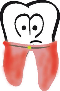 parodontose